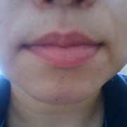 「ひげが・・・。」女のうっかり毛コンテスト！優勝者にはフェイスヘアーブロック3本プレゼント！の投稿画像