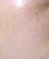 口コミ：Ｂｌａｎｃ Ｂｌａｎｃ　ＭＩＸＧＥＬ（ミックスジェル）でうるぷる美肌へ！！の画像（1枚目）