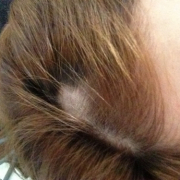 「悩み」【8万円相当！6箱分長期モニター】薄毛に悩む方に。女性用サプリ「ヘアドルーチェ」の投稿画像