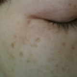 シミだらけ&hellip;