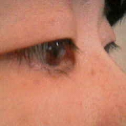 「目もとの」頑固なシミを消したい人大募集！デルミサスキンフェイドクリーム＆ローションの投稿画像