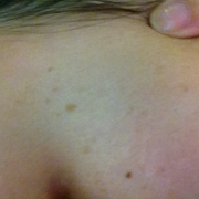 「まだ」頑固なシミを消したい人大募集！デルミサスキンフェイドクリーム＆ローションの投稿画像