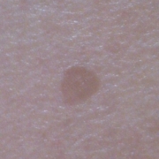 「年々酷くなるシミ」頑固なシミを消したい人大募集！デルミサスキンフェイドクリーム＆ローションの投稿画像