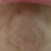 「ぼこぼこ　しわしわ」あごのしわの悩みについての声聞かせてください！アンケートに答えるだけ！の投稿画像