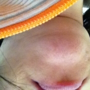 「あごライン」あごのしわの悩みについての声聞かせてください！アンケートに答えるだけ！の投稿画像