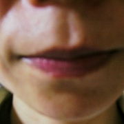 「ほうれい線からの・・」あごのしわの悩みについての声聞かせてください！アンケートに答えるだけ！の投稿画像