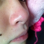 「毛穴」顔だしモニター募集　発売前【ニキビケア美容液＆ローション】を10名様に！の投稿画像