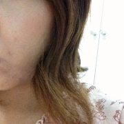 「化粧をしても隠れない」顔だしモニター募集　発売前【ニキビケア美容液＆ローション】を10名様に！の投稿画像