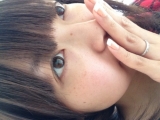 シミの画像