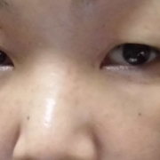 「シミシミ軍団　どこかに行って！」来年夏発売予定！純ハイドロキノン配合美容液モニター大募集！の投稿画像