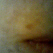 「口元の」来年夏発売予定！純ハイドロキノン配合美容液モニター大募集！の投稿画像