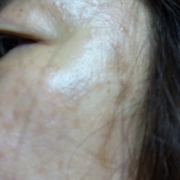 「汚いシミ」来年夏発売予定！純ハイドロキノン配合美容液モニター大募集！の投稿画像