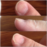 コンプレックスです(*_*)