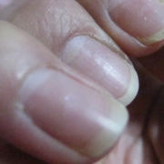 「いくら手入れしても・・・」爪が薄い、割れる、でこぼこに！フランス発のネイルエッセンス現品モニター募集の投稿画像