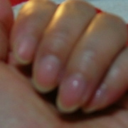 「爪」爪が薄い、割れる、でこぼこに！フランス発のネイルエッセンス現品モニター募集の投稿画像