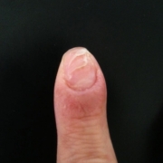 「こんな状態初めて！」爪が薄い、割れる、でこぼこに！フランス発のネイルエッセンス現品モニター募集の投稿画像