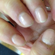 「乾燥で、、、」爪が薄い、割れる、でこぼこに！フランス発のネイルエッセンス現品モニター募集の投稿画像