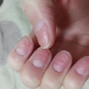 「出産してから4年・・・」爪が薄い、割れる、でこぼこに！フランス発のネイルエッセンス現品モニター募集の投稿画像