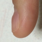 「凸凹」爪が薄い、割れる、でこぼこに！フランス発のネイルエッセンス現品モニター募集の投稿画像