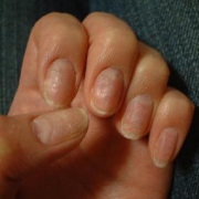 「乾燥・凸凹・割れやすいのそろい踏み」爪が薄い、割れる、でこぼこに！フランス発のネイルエッセンス現品モニター募集の投稿画像