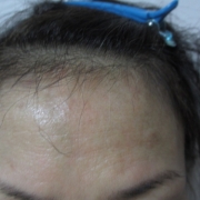 「しわ、シミ、にきび痕、毛穴、赤みなどなど」顔だしモニター募集　発売前【細胞再生ケア オールインワンゲル】を10名様に！の投稿画像