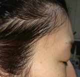 「実際に薄くなりました。」の画像（1枚目）