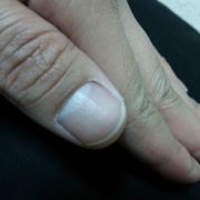 「ガサガサゴワゴワ」爪が薄い、割れる、でこぼこに！フランス発のネイルエッセンス現品モニター募集の投稿画像