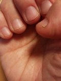 「私の爪」の画像（1枚目）