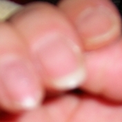 「すぐに割れてしまいます・・・」爪が薄い、割れる、でこぼこに！フランス発のネイルエッセンス現品モニター募集の投稿画像