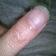 「綺麗にしたい。」爪が薄い、割れる、でこぼこに！フランス発のネイルエッセンス現品モニター募集の投稿画像