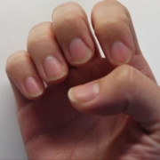 「爪」爪が薄い、割れる、でこぼこに！フランス発のネイルエッセンス現品モニター募集の投稿画像