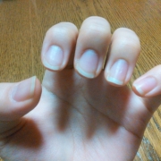 「爪」爪が薄い、割れる、でこぼこに！フランス発のネイルエッセンス現品モニター募集の投稿画像