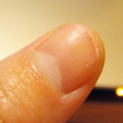 「深刻な悩み」爪が薄い、割れる、でこぼこに！フランス発のネイルエッセンス現品モニター募集の投稿画像