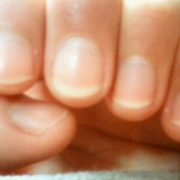 「ささくれ・皮膚が弱い乾燥↓↓爪表面のザラつきｗｗｗ」爪が薄い、割れる、でこぼこに！フランス発のネイルエッセンス現品モニター募集の投稿画像