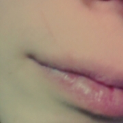 「ニキビが繰り返しできる」薬用ニキビケア【アクネル アクネクリアローション＋AZセラム】を20名様に！の投稿画像