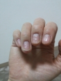 「爪の凸凹」の画像（1枚目）