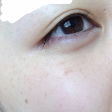 ファンデーションでも隠しきれない&hellip;