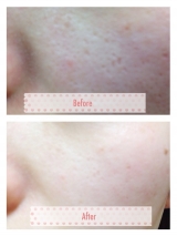 口コミ：【継続中☆コスメ使用日記】☆エイジングリペアの画像（2枚目）