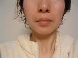 「肌の色が白くなり、顔全体が引き締まって見えます。」の画像（2枚目）
