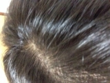 使った後の頭皮と毛