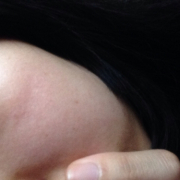 「目の下のくすみ、しみ、傷です」今年夏発売予定！純ハイドロキノン配合美容液モニター大募集！の投稿画像