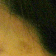 「こめかみと頬。」今年夏発売予定！純ハイドロキノン配合美容液モニター大募集！の投稿画像