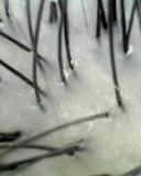 「頭皮から綺麗に！」の画像（1枚目）