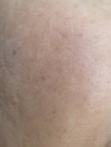 口コミ：納豆エキスが入ったジェルで美白してますの画像（2枚目）