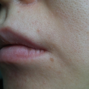 「ひげ部分」長期モニター募集！女のヒゲに眉毛に！フランス発の顔用抑毛美容液！の投稿画像