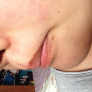 「ひげ」長期モニター募集！女のヒゲに眉毛に！フランス発の顔用抑毛美容液！の投稿画像