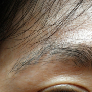 「継続モニター希望！」長期モニター募集！女のヒゲに眉毛に！フランス発の顔用抑毛美容液！の投稿画像