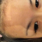 「おでこ」長期モニター募集！女のヒゲに眉毛に！フランス発の顔用抑毛美容液！の投稿画像