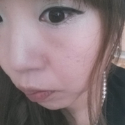 「ニキビあと。。消えません。。(泣)」顔写真掲載可能な方！ニキビ跡専用美容液のモニター10名の投稿画像