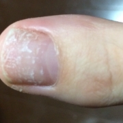 「ジェルネイルの後…」【長期モニター】フランス発のネイルエッセンス現品モニター募集の投稿画像